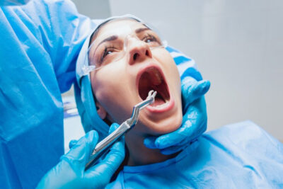 Extraction dents